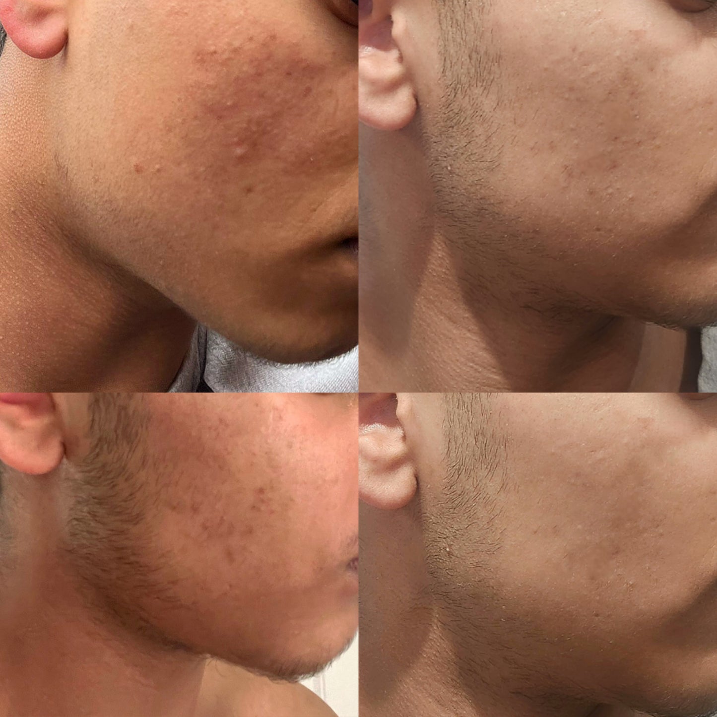 Bamboo & Olive glow bundle - Shanaz Riasoth 