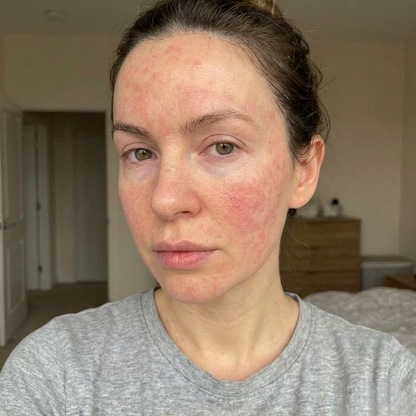 Olive Glow - Shanaz Riasoth 