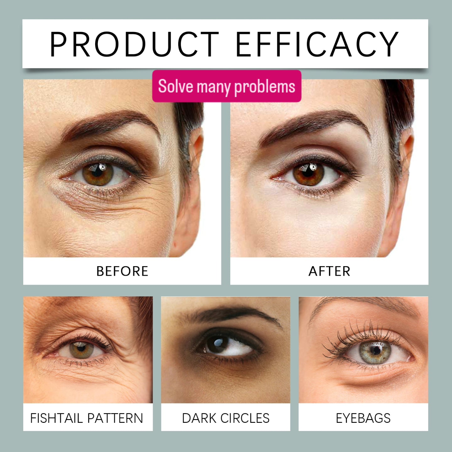 Hyaluronic microneedle eye patches - Shanaz Riasoth 